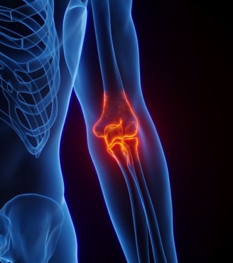 Επικονδυλίτιδα